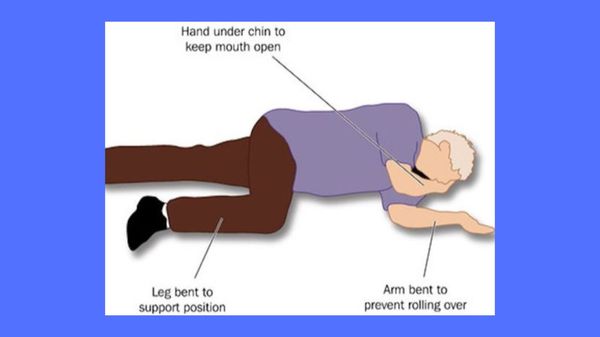 When is it necessary to put a casualty in a recovery position?